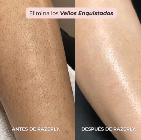 MAQUINILLA CORPORAL 2 EN 1