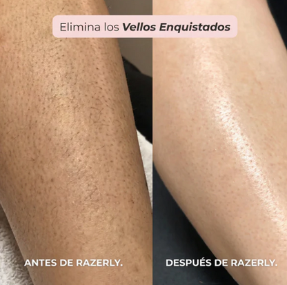 MAQUINILLA CORPORAL 2 EN 1